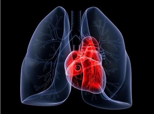 新型虚拟筛查工具可简化并加速肺动脉高压的常规诊断