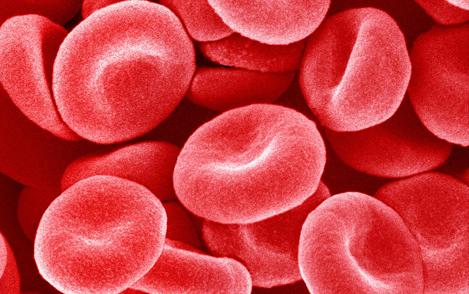 红细胞水平较高的输血不能改善早产