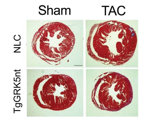 停止信号分子的基因调节活性有助于预防心力衰竭