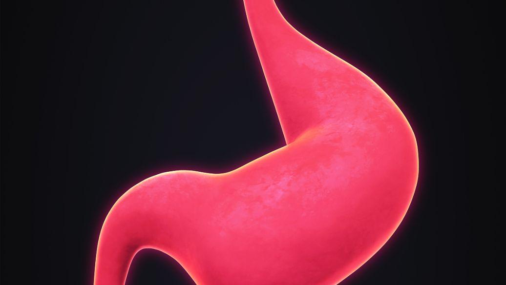 AGA建议将胃内球囊作为肥胖患者的另一种减肥策略