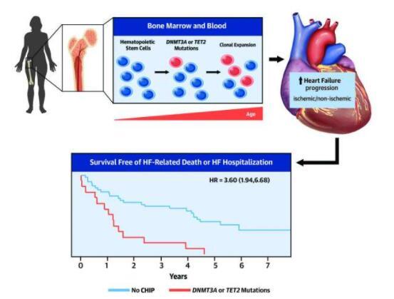 血细胞突变会加速心力衰竭的进展