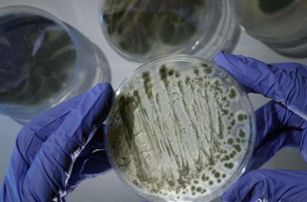 致命真菌的新发现可能是治疗的关键