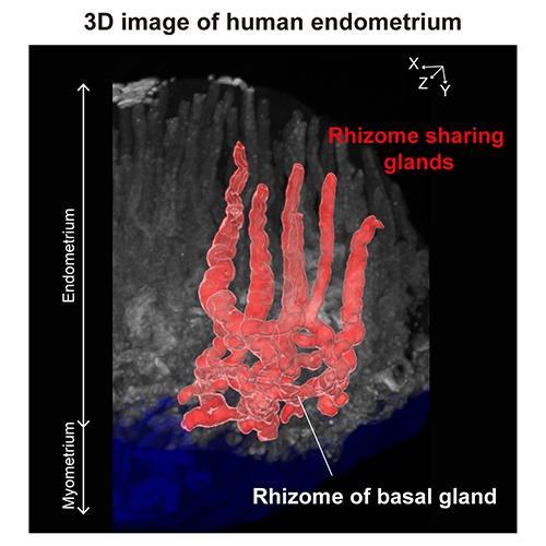 研究揭示了人子宫内膜和子宫腺肌病组织的3D结构