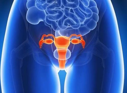 子宫颈癌患者子宫穿孔后可能会继续进行近距离放射治疗