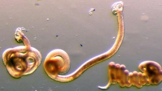 蠕虫感染使非洲妇女更容易感染性传播疾病