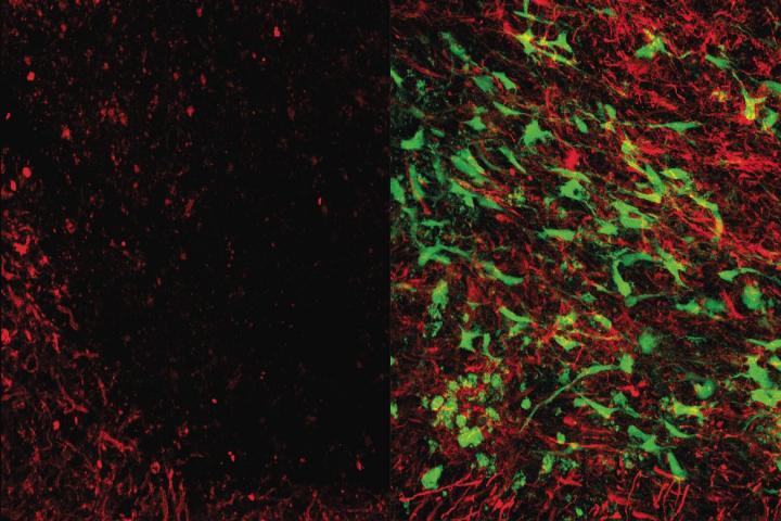 干细胞疗法促进小鼠中风和痴呆症的恢复