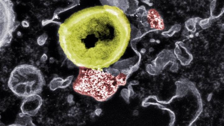 研究人员用纳米粒子对抗有害细菌