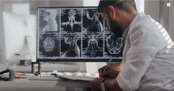 新的MRI技术可以检测小血管疾病的早期血脑屏障功能障碍