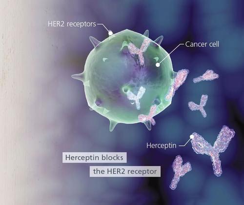 研究团队发现了一种导致赫赛汀抗性的机制