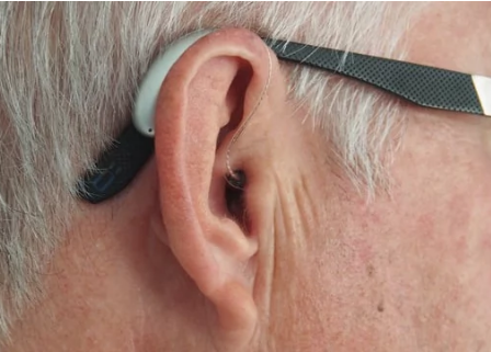 如何预防由癌症药物引起的永久性听力损失