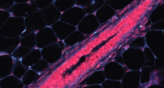 研究人员分类细胞以查明乳腺癌的起源