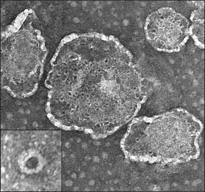 人类细胞和致病性志贺氏菌如何参与战斗