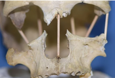 研究人员成功测序了35,000年的头骨