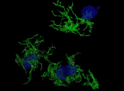 研究人员发现噬斑小胶质细胞的基因特征