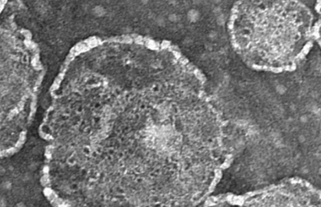 致病性志贺氏菌与我们的细胞之间的斗争