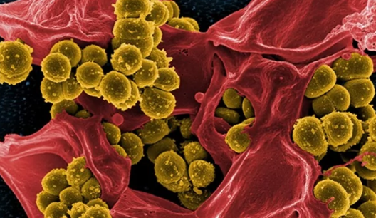 无害微生物如何成为致命病原体