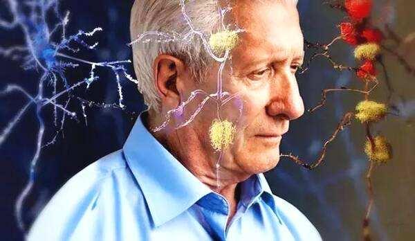 继发感染使大脑发炎并恶化阿尔茨海默病的认知