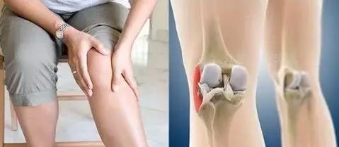 研究检查膝关节骨关节炎患者接受的护理