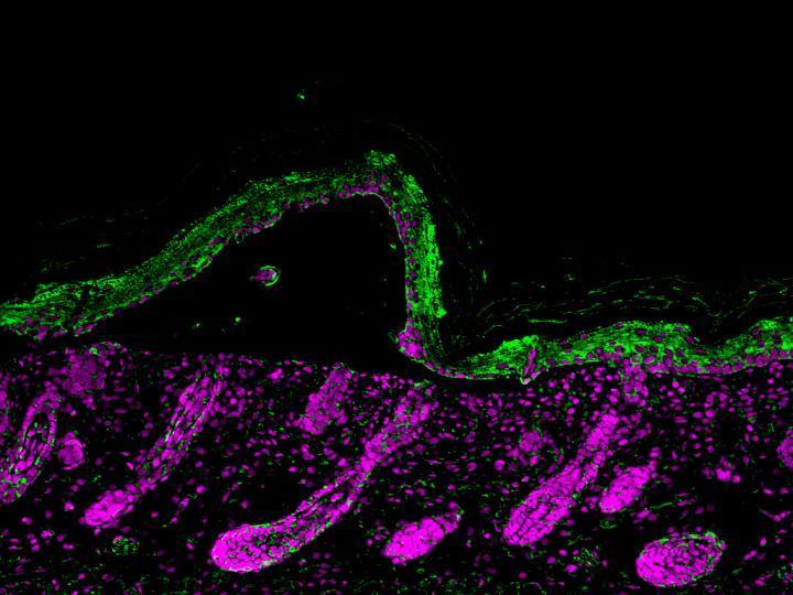 一组科学家已经表明皮肤水疱的愈合是由毛囊干细胞驱动的