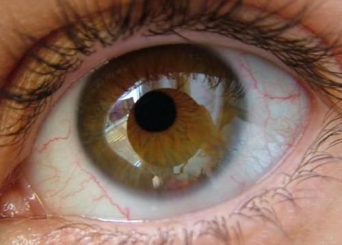 非接触式技术可以及早发现和治疗导致失明的眼病