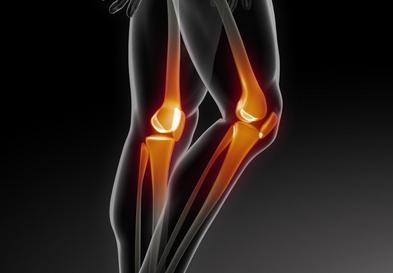 了解成骨不全症中关节和肌腱功能障碍的原因
