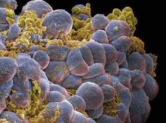 癌细胞和正常细胞所含有的微核糖核酸种类不同