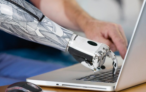 人工智能和机器学习如何改变假肢