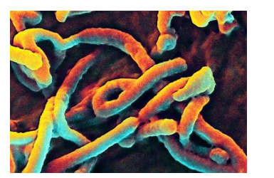 研究人员发现埃博拉病毒如何破坏免疫系统