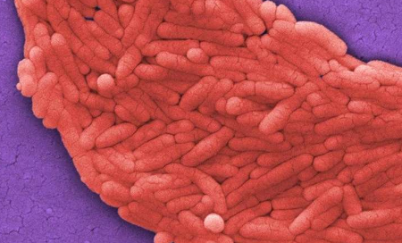 研究人员绘制了沙门氏菌和败血症之间的联系