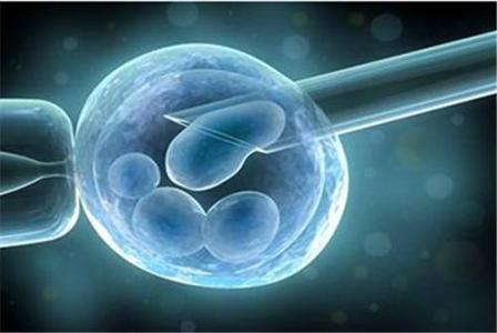 体外受精IVF胎龄增加超过25年
