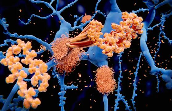 改变大脑DNA暗示了一种全新的治疗阿尔茨海默氏病的方法