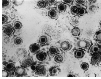 新的生殖器疱疹疫苗候选物在临床前测试中提供强有力的保护