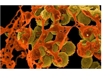 科学家发现了一种攻击金黄色葡萄球菌细菌的新方法