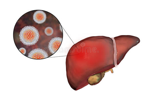 受丙型肝炎感染的肝脏与健康肝脏的结果相似