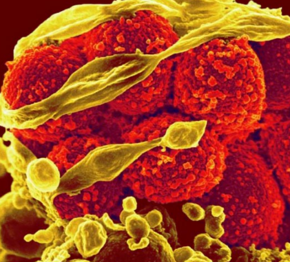香烟烟雾使耐甲氧西林的金黄色葡萄球菌更具攻击性