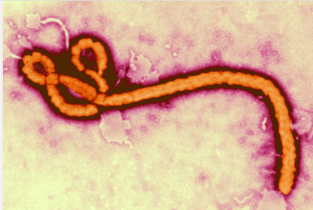 新研究发现埃博拉病毒和其他丝状病毒至少有1600万年的历史