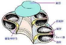 人工耳蜗植入体对密封安全的要求极高