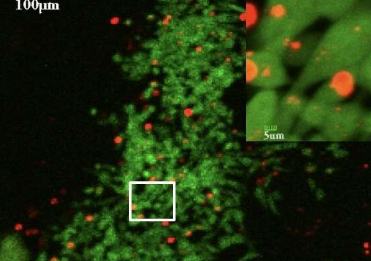 研究人员使用纳米粒子测量活体动物的癌细胞力学