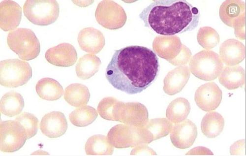 白血病干细胞是白血病患者体内存在的一群极微量的细胞群