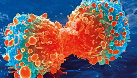 针对肺部休眠的乳腺癌细胞可以减少继发性癌症
