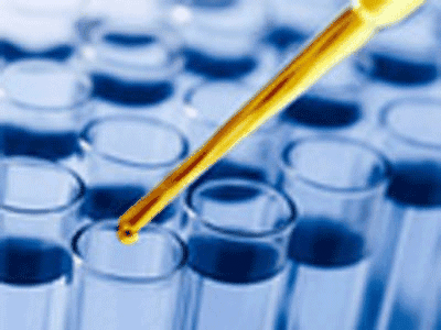 研究表明生物标记物可以准确诊断致命的婴儿疾病