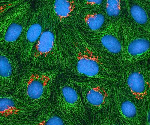 细胞蛋白作为癌症发展的气泵伴随者