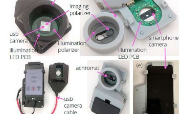 创新的智能手机 相机适配图像可显示黑色素瘤和非黑色素瘤