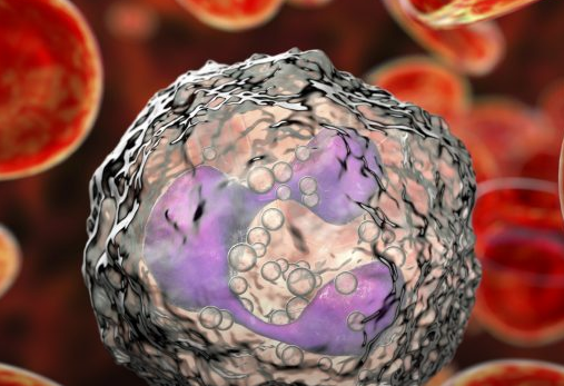 纳米粒子和抗癌药物联合靶向炎性中性粒细胞