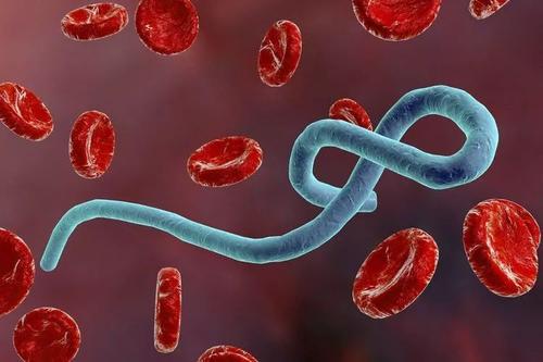 埃博拉幸存者研究得出有关疾病并发症的见解