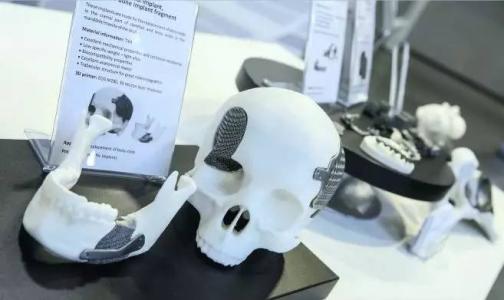 3-D打印软材料的新方法为制造人造医疗植入物迈出了重要一步