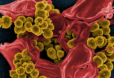 研究人员发现新的抗生素抗性基因