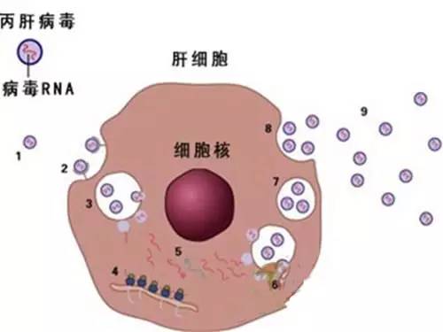 帮助医生预测诊断为丙型肝炎的患者的下一步