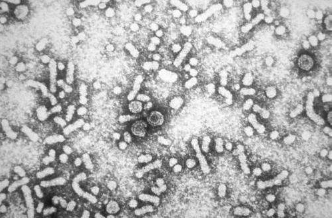 研究发现 母亲的乙型肝炎支持儿童的慢性感染
