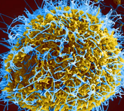 塞拉利昂发现无症状埃博拉病毒